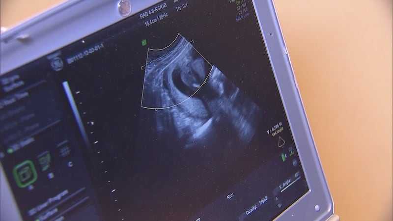 中山大学附属第三医院做二代试管供卵排名的成功率怎么样?